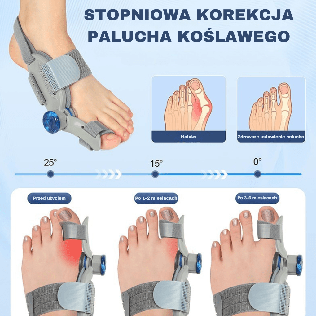 HalluCare - korektor haluksów 
(jedna sztuka)